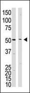 Presenilin 1 antibody, PA5-13214, Invitrogen Antibodies, Western Blot image 
