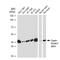 Casein Kinase 2 Alpha 1 antibody, GTX01541, GeneTex, Western Blot image 