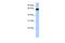 Zinc Finger Protein 100 antibody, A16944, Boster Biological Technology, Western Blot image 