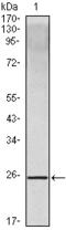 Interleukin 10 antibody, STJ98167, St John