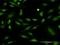 Protein Kinase C Delta antibody, H00005580-M07, Novus Biologicals, Immunocytochemistry image 