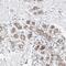 Outer Dense Fiber Of Sperm Tails 2 Like antibody, NBP1-82922, Novus Biologicals, Immunohistochemistry frozen image 