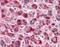Catalase antibody, 45-026, ProSci, Enzyme Linked Immunosorbent Assay image 