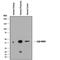 Hydroxysteroid 11-Beta Dehydrogenase 2 antibody, MAB8630, R&D Systems, Western Blot image 