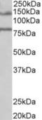 Erythrocyte Membrane Protein Band 4.1 Like 5 antibody, NB100-93392, Novus Biologicals, Western Blot image 