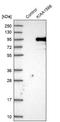 KIAA1586 antibody, NBP1-86291, Novus Biologicals, Western Blot image 