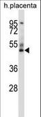 GRAM Domain Containing 2B antibody, LS-C166659, Lifespan Biosciences, Western Blot image 