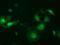 Protein lin-7 homolog B antibody, MA5-25208, Invitrogen Antibodies, Immunocytochemistry image 