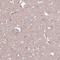 Dipeptidyl Peptidase Like 10 antibody, HPA048767, Atlas Antibodies, Immunohistochemistry paraffin image 