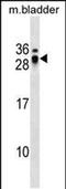 Endothelial Cell Surface Expressed Chemotaxis And Apoptosis Regulator antibody, PA5-48941, Invitrogen Antibodies, Western Blot image 