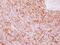 5'-Nucleotidase Ecto antibody, PA5-29750, Invitrogen Antibodies, Immunohistochemistry paraffin image 