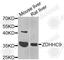 Zinc Finger DHHC-Type Containing 9 antibody, A7977, ABclonal Technology, Western Blot image 