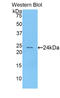 Acetylcholinesterase antibody, LS-C292588, Lifespan Biosciences, Western Blot image 