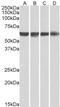 Polypyrimidine Tract Binding Protein 1 antibody, 46-243, ProSci, Immunohistochemistry paraffin image 