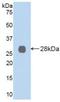 Lysyl Oxidase Like 2 antibody, MBS2027442, MyBioSource, Western Blot image 