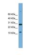 T-cell acute lymphocytic leukemia protein 2 homolog antibody, orb324672, Biorbyt, Western Blot image 