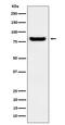 Protein Kinase C Substrate 80K-H antibody, M04992, Boster Biological Technology, Western Blot image 