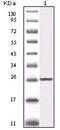 Inhibitor Of Nuclear Factor Kappa B Kinase Subunit Beta antibody, abx016029, Abbexa, Enzyme Linked Immunosorbent Assay image 