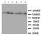 Matrilin 2 antibody, LS-C313062, Lifespan Biosciences, Western Blot image 