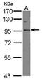 Elongation Factor Tu GTP Binding Domain Containing 2 antibody, GTX115222, GeneTex, Western Blot image 