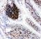 Vascular Cell Adhesion Molecule 1 antibody, PA1873, Boster Biological Technology, Immunohistochemistry paraffin image 