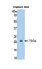 Membrane Metalloendopeptidase antibody, LS-C295564, Lifespan Biosciences, Western Blot image 