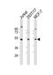 Serine/threonine-protein kinase VRK1 antibody, 62-888, ProSci, Western Blot image 