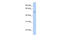 Zinc Finger And SCAN Domain Containing 32 antibody, 25-302, ProSci, Western Blot image 