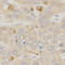 Thyroid Hormone Receptor Beta antibody, LS-C331560, Lifespan Biosciences, Immunohistochemistry paraffin image 