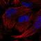 Gem Nuclear Organelle Associated Protein 5 antibody, PA5-65187, Invitrogen Antibodies, Immunofluorescence image 