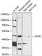 Natural Cytotoxicity Triggering Receptor 1 antibody, 15-574, ProSci, Western Blot image 