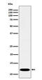 Pterin-4 Alpha-Carbinolamine Dehydratase 1 antibody, M07264, Boster Biological Technology, Western Blot image 