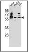 Pyruvate Dehyrogenase Phosphatase Catalytic Subunit 1 antibody, AP53246PU-N, Origene, Western Blot image 