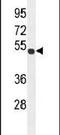 Transmembrane Protein 266 antibody, PA5-24298, Invitrogen Antibodies, Western Blot image 