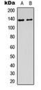 DEAH-Box Helicase 8 antibody, orb256496, Biorbyt, Western Blot image 