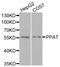 Phosphoribosyl Pyrophosphate Amidotransferase antibody, A6698, ABclonal Technology, Western Blot image 