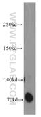 Dynein Cytoplasmic 1 Intermediate Chain 1 antibody, 13808-1-AP, Proteintech Group, Western Blot image 