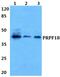 Pre-MRNA Processing Factor 18 antibody, PA5-37022, Invitrogen Antibodies, Western Blot image 