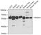 Regulator Of Microtubule Dynamics 3 antibody, GTX54674, GeneTex, Western Blot image 