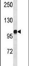 Diacylglycerol Kinase Iota antibody, PA5-15408, Invitrogen Antibodies, Western Blot image 