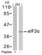 Eukaryotic Translation Initiation Factor 2 Subunit Alpha antibody, 79-395, ProSci, Western Blot image 