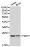 Phosphatidylethanolamine Binding Protein 1 antibody, LS-C192396, Lifespan Biosciences, Western Blot image 