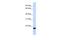 Zinc Finger Protein 428 antibody, A17423, Boster Biological Technology, Western Blot image 