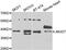 Jumonji Domain Containing 7 antibody, LS-C349122, Lifespan Biosciences, Western Blot image 