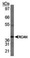 Regulator Of Calcineurin 1 antibody, PA5-23027, Invitrogen Antibodies, Western Blot image 