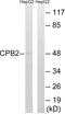 Carboxypeptidase B2 antibody, A30594, Boster Biological Technology, Western Blot image 