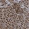 Protein Phosphatase 1 Regulatory Subunit 15A antibody, NBP1-89800, Novus Biologicals, Immunohistochemistry paraffin image 