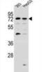 GTPase, IMAP Family Member 8 antibody, abx027293, Abbexa, Western Blot image 