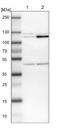 Hexokinase Domain Containing 1 antibody, NBP1-82108, Novus Biologicals, Immunohistochemistry paraffin image 