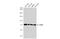 P21 (RAC1) Activated Kinase 6 antibody, GTX127915, GeneTex, Western Blot image 